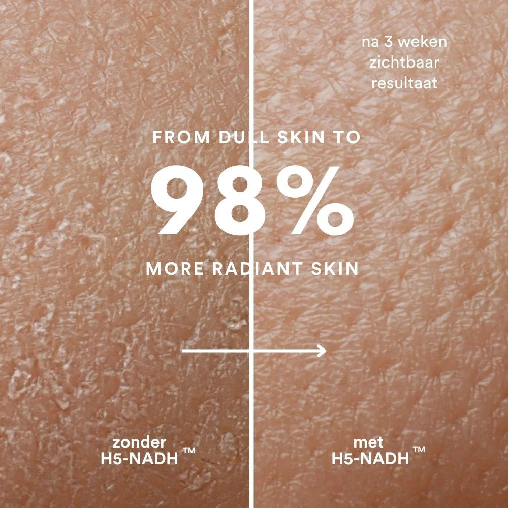 Close-up van de huidtextuur: linkerkant &quot;zonder Insentials Anti-Aging Pack&quot;, rechterkant &quot;met Insentials Anti-Aging Pack&quot;. Tekst: 98% meer stralende huid na 3 weken.